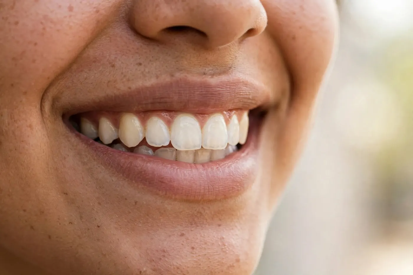 Sonrisa sana y blanca de una mujer